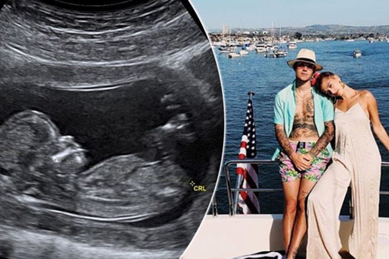 Prvoaprilska šala: Justin Bieber objavio da Hailey čeka bebu, njoj nije bilo smešno
